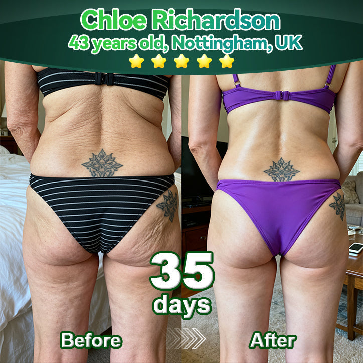 Lotmay® Orální Kapky s Kmenovými Buňkami & Kolagenovými Peptidy 👩‍⚕️ (Pro zpevnění povadlé pleti & redukci tvorby vrásek) 🌿