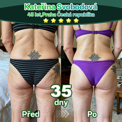 Lotmay® Kapky s kmenovými buňkami a kolagenovými peptidy pro vnitřní použití👩‍⚕️ (Zpevnění a lifting povolené pokožky & redukce tvorby vrásek) 🍀💥💥