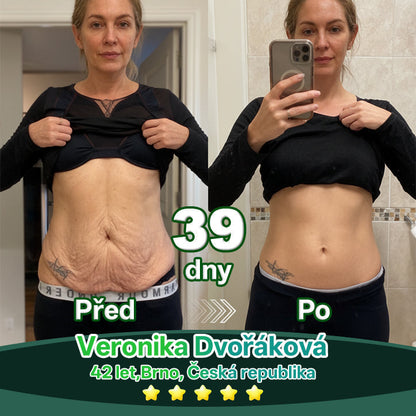 Lotmay® Kapky s kmenovými buňkami a kolagenovými peptidy pro vnitřní použití👩‍⚕️ (Zpevnění a lifting povolené pokožky & redukce tvorby vrásek) 🍀💥💥