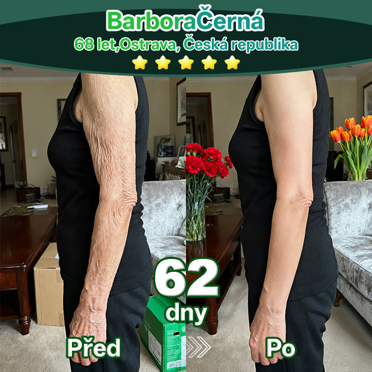 Lotmay® Kapky s kmenovými buňkami a kolagenovými peptidy pro vnitřní použití👩‍⚕️ (Zpevnění a lifting povolené pokožky & redukce tvorby vrásek) 🍀💥💥