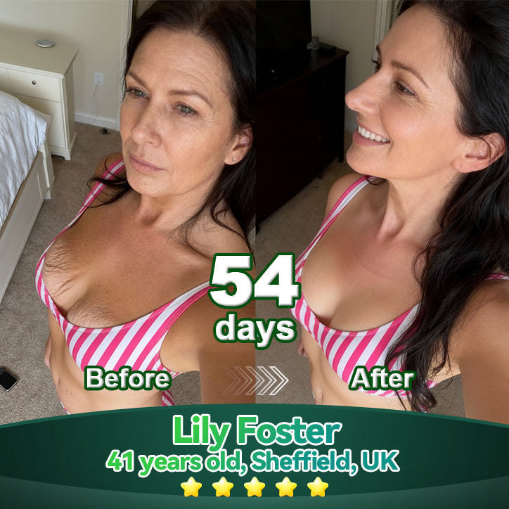 Lotmay® Orální Kapky s Kmenovými Buňkami & Kolagenovými Peptidy 👩‍⚕️ (Pro zpevnění povadlé pleti & redukci tvorby vrásek) 🌿