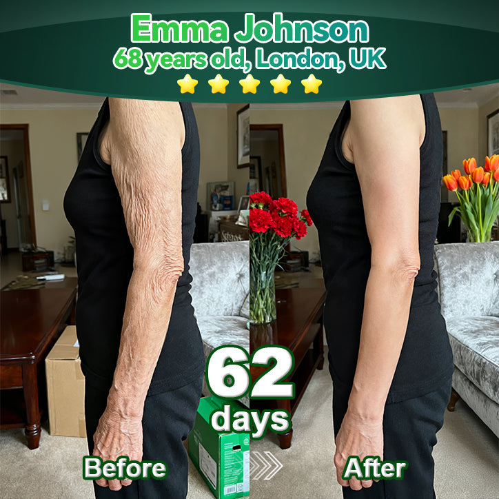 Lotmay® Orální Kapky s Kmenovými Buňkami & Kolagenovými Peptidy 👩‍⚕️ (Pro zpevnění povadlé pleti & redukci tvorby vrásek) 🌿