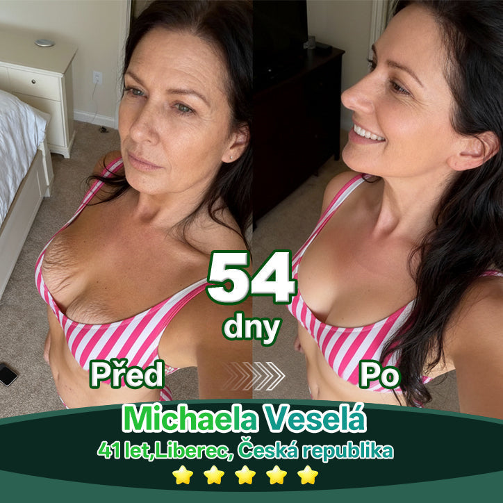 Lotmay® Kapky s kmenovými buňkami a kolagenovými peptidy pro vnitřní použití👩‍⚕️ (Zpevnění a lifting povolené pokožky & redukce tvorby vrásek) 🍀💥💥