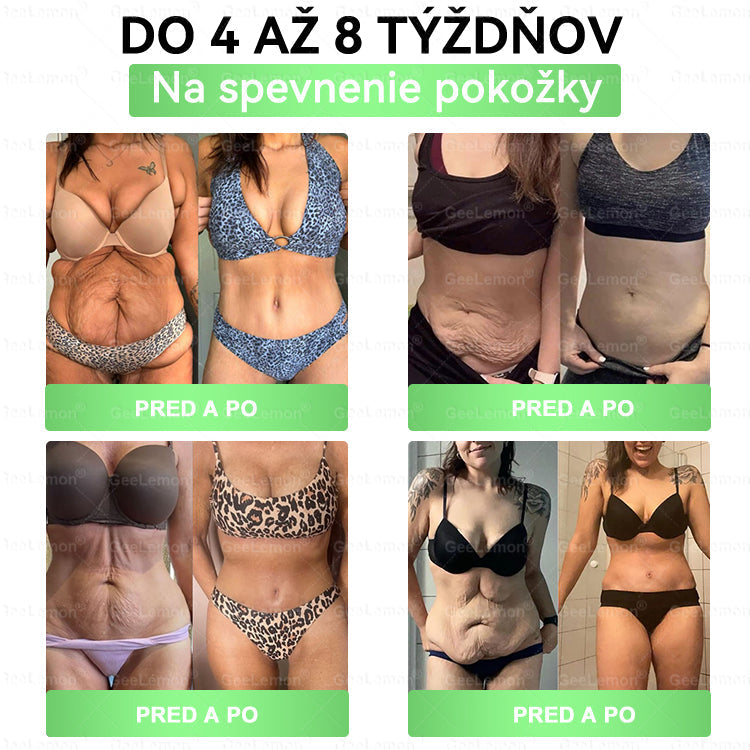 Odporúčané UNB · 👩‍⚕️Oficiálny obchod Dr. Max | 🎁 𝐆𝐞𝑒𝐿𝑒𝐦𝐨𝐧® Glumasetide 8 v 1 Nano mikrotŕňový náplasť – Len raz denne ✅ Viditeľné zmeny za 7 dní na obezitu, ochabnutú pokožku a zdravie